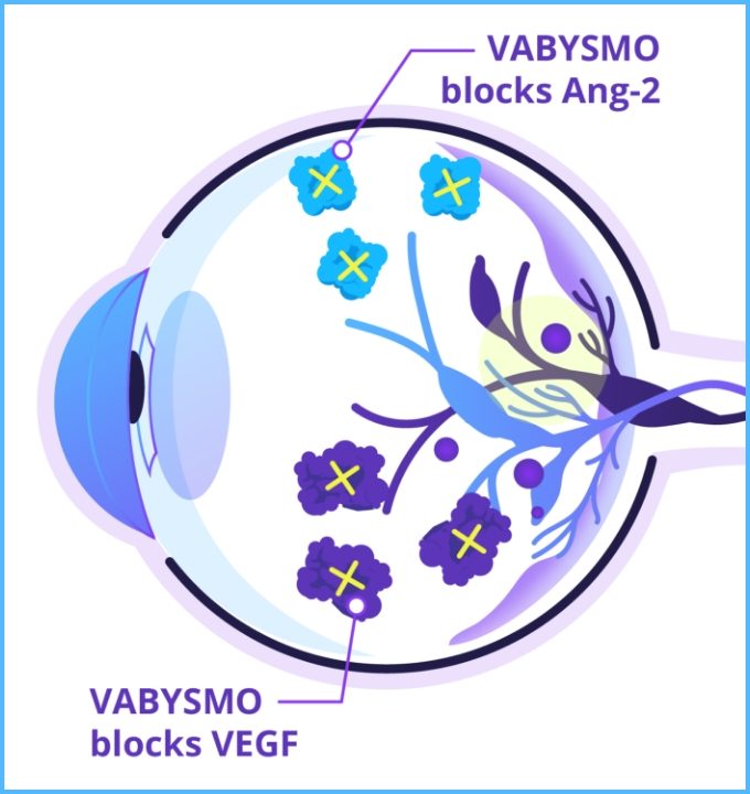 Eyeball graphic depicting VABYSMO blocking of VEGF and Ang-2